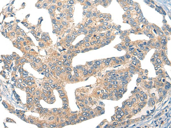 GPR55 Polyclonal Antibody (E-AB-17848)