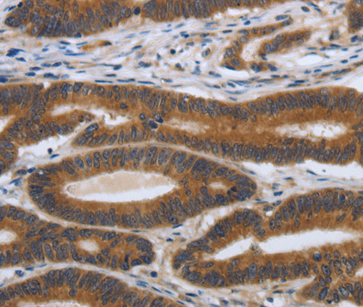 PDGFA Polyclonal Antibody (E-AB-12839)