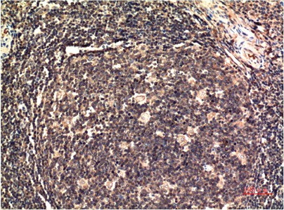 ERK 1 Monoclonal Antibody (E-AB-22246)