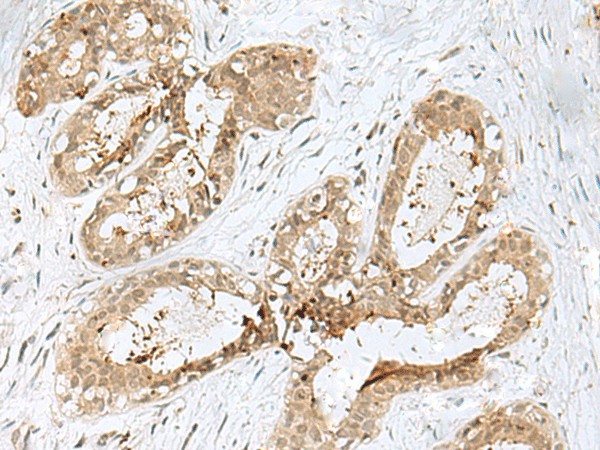 PSMA4 Polyclonal Antibody (E-AB-18807)