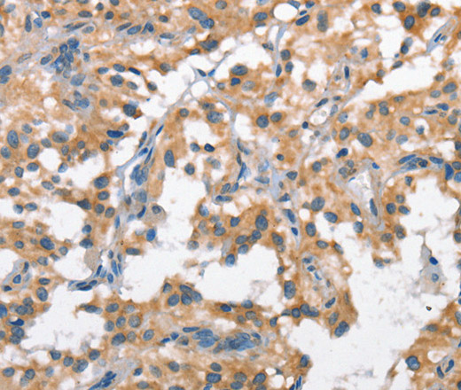 SCARB1 Polyclonal Antibody (E-AB-10361)