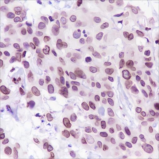 Recombinant FBXW7 Monoclonal Antibody (AN301521L)