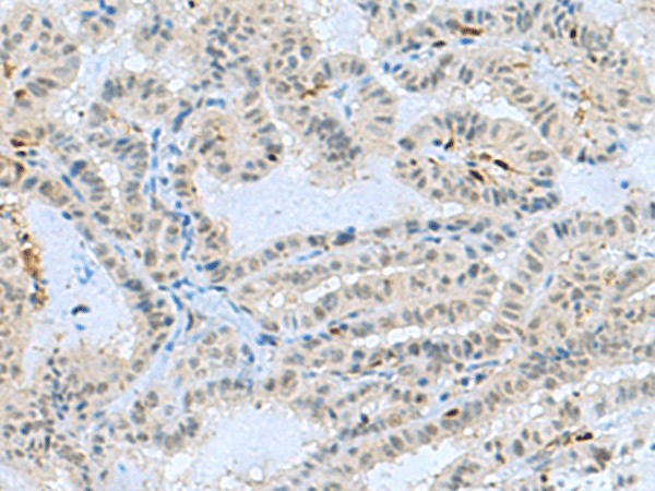 TCF19 Polyclonal Antibody (E-AB-53156)
