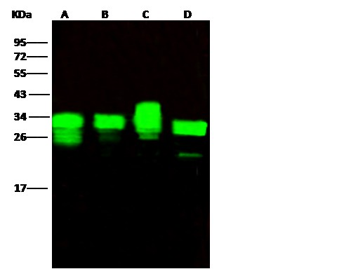 Recombinant PA28A/PSME1 Monoclonal Antibody (AN300164P)
