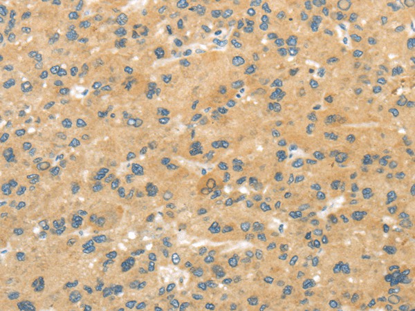 MPP6 Polyclonal Antibody (E-AB-17539)