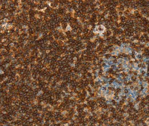 CD43 Polyclonal Antibody (E-AB-14852)