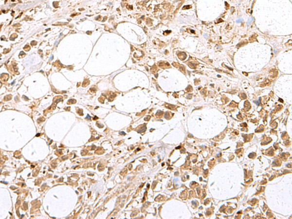 RBFOX2 Polyclonal Antibody (E-AB-18996)