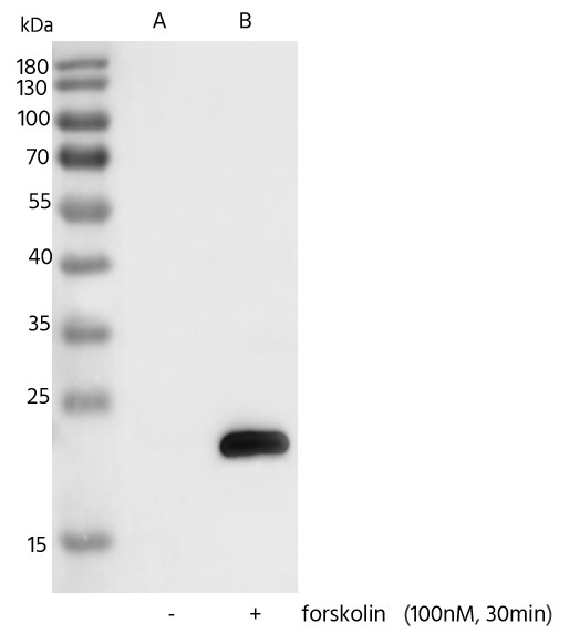 Recombinant Phospho-Bad (Ser99) Monoclonal Antibody (AN300150L)