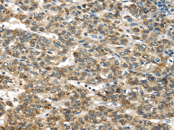 TNFAIP2 Polyclonal Antibody (E-AB-17124)