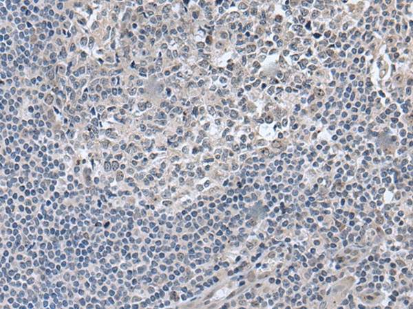 EDARADD Polyclonal Antibody (E-AB-52310)