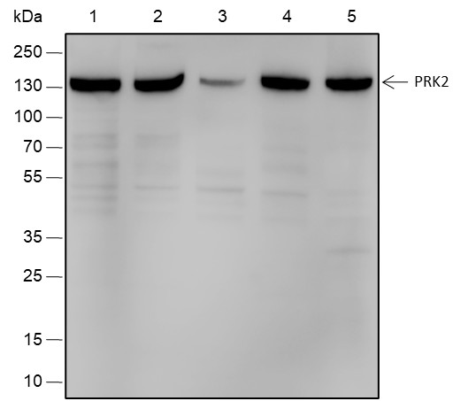 Recombinant PRK2 Monoclonal Antibody (AN301803L)