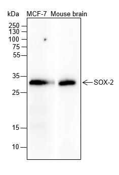Recombinant SOX2 Monoclonal Antibody (AN301662L)
