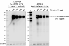 Purified anti-SARS-CoV-2 S Protein S1 Recombinant Antibody (940401)