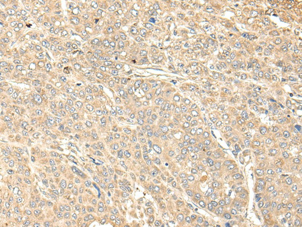 WDFY4 Polyclonal Antibody (E-AB-18485)