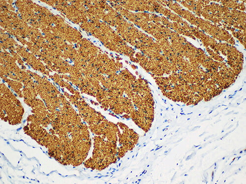 SMA Monoclonal Antibody (ELAB6566-M)