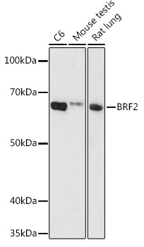 BRF2 Polyclonal Antibody (E-AB-92912)