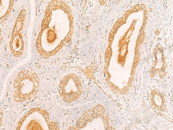 ZNF580 Polyclonal Antibody (E-AB-18913)