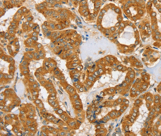 PDP1 Polyclonal Antibody (E-AB-11496)