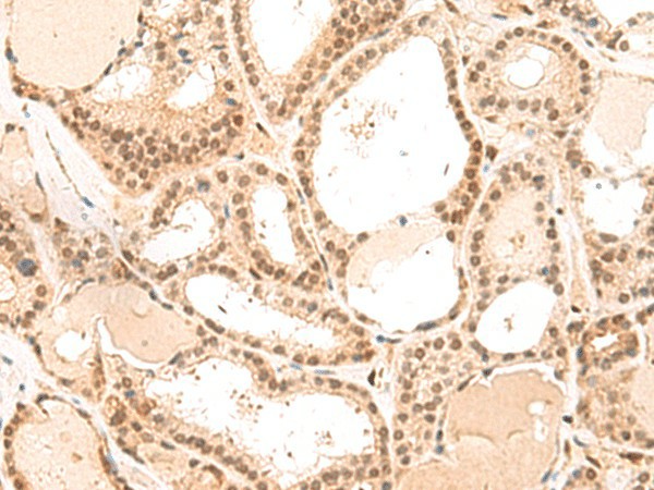 MKX Polyclonal Antibody (E-AB-52906)