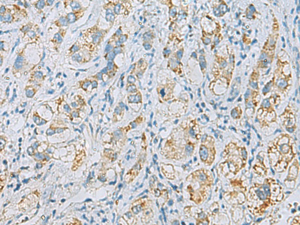 PLA2G15 Polyclonal Antibody (E-AB-19213)