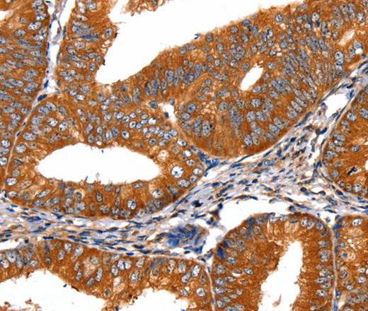 FGFR1 Polyclonal Antibody (E-AB-10320)