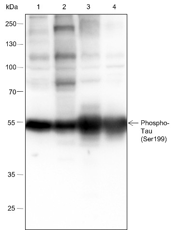 Recombinant Phospho-Tau (Ser199) Monoclonal Antibody (AN302079L)
