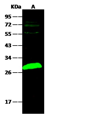 Recombinant UCHL1 Monoclonal Antibody (AN300545P)