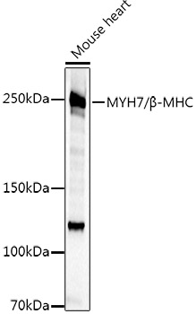 MYH7 Polyclonal Antibody (E-AB-68406)