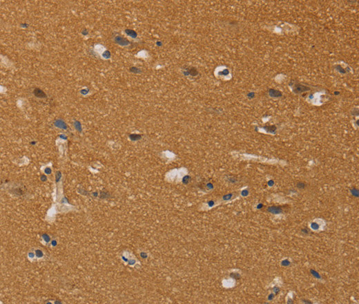 CHRNA4 Polyclonal Antibody (E-AB-10481)