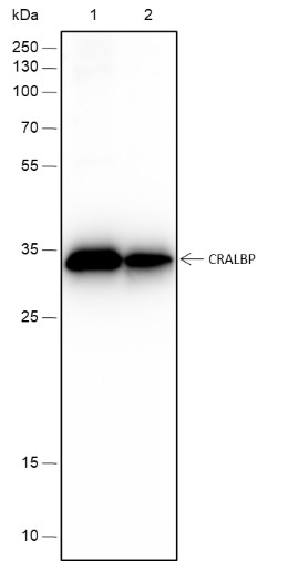 Recombinant CRALBP Monoclonal Antibody (AN301499L)
