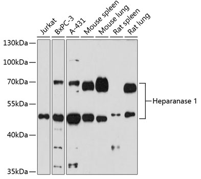 Heparanase 1 Polyclonal Antibody (E-AB-66830)