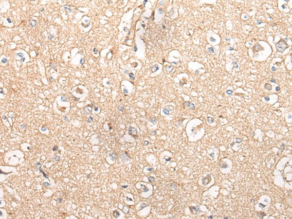 MTNR1B Polyclonal Antibody (E-AB-53402)