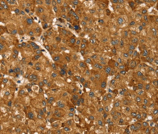TBC1D1 Polyclonal Antibody (E-AB-16909)