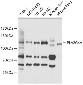 PLA2G4A Polyclonal Antibody (E-AB-90015)