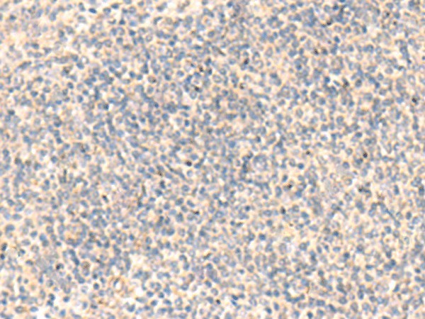 ADAMTS2 Polyclonal Antibody (E-AB-19434)