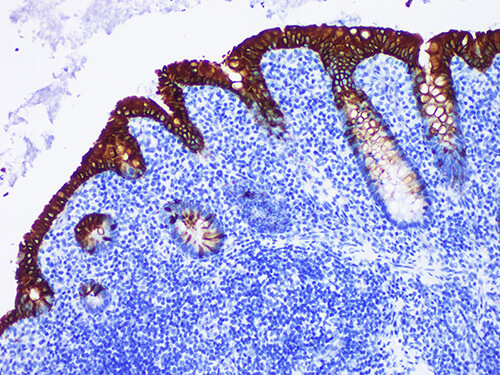 CK20 Monoclonal Antibody (ELAB6037-M)