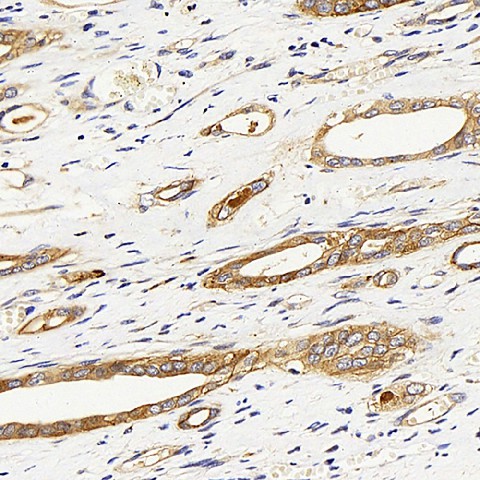 ITGAV Polyclonal Antibody (E-AB-70153)