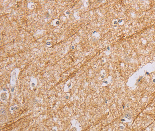 BGLAP Polyclonal Antibody (E-AB-16278)