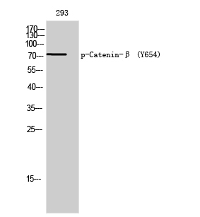 Phospho-Catenin beta (Tyr654) Polyclonal Antibody (E-AB-20830)