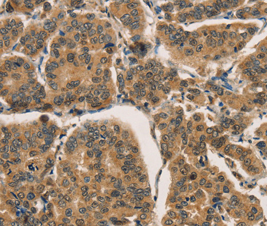 CTNNBIP1 Polyclonal Antibody (E-AB-11109)