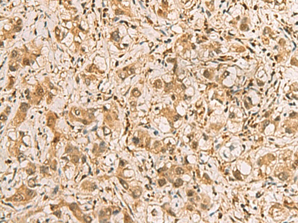 PDXK Polyclonal Antibody (E-AB-19225)