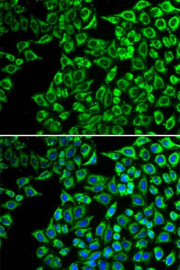 LIPC Polyclonal Antibody (E-AB-64685)
