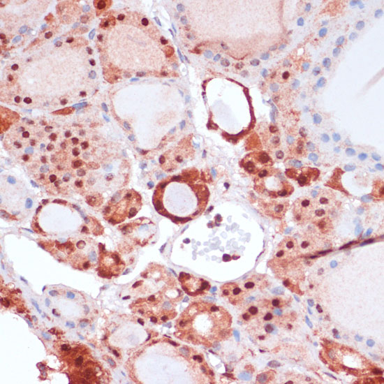 S100A5 Polyclonal Antibody (E-AB-66346)