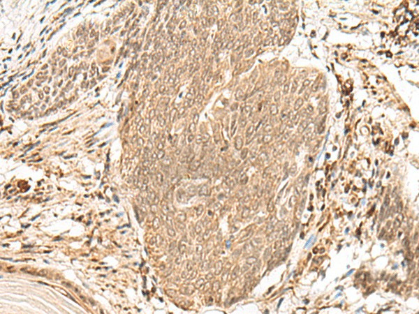 VPS50 Polyclonal Antibody (E-AB-17967)