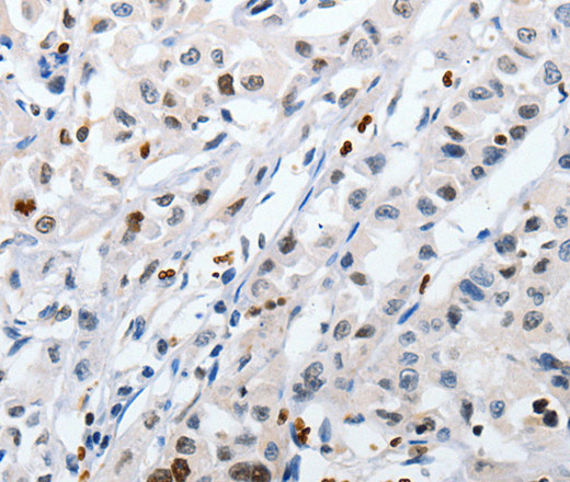 HSPA1A Polyclonal Antibody (E-AB-10376)