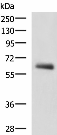 KBTBD11 Polyclonal Antibody (E-AB-18161)