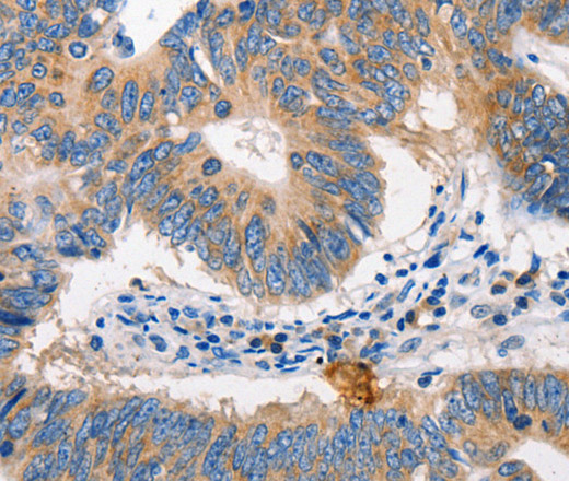 MTOR Polyclonal Antibody (E-AB-15789)