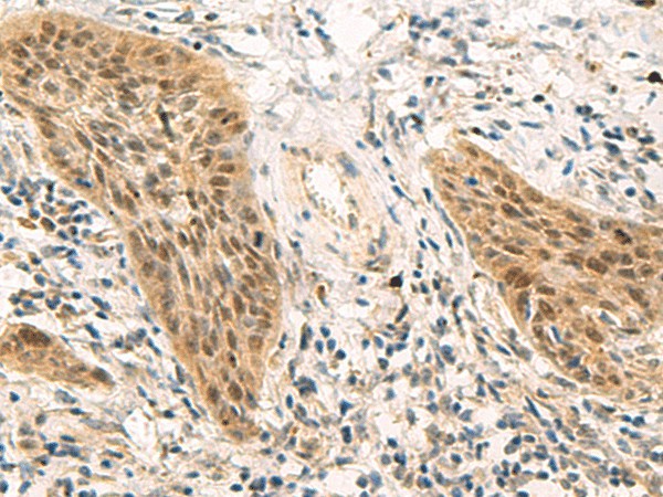 PSME1 Polyclonal Antibody (E-AB-19193)