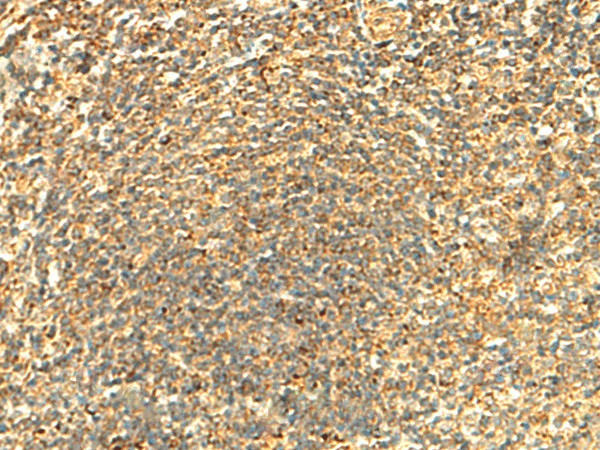 ABHD10 Polyclonal Antibody (E-AB-18966)