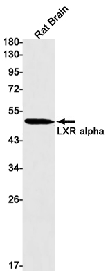 Recombinant LXR alpha Monoclonal Antibody (E-AB-81580)